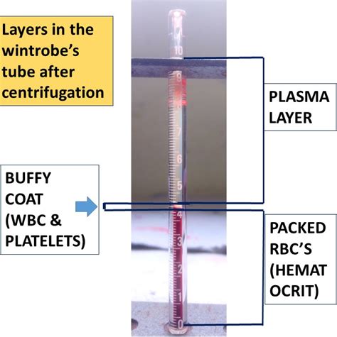 wintrobe tube diagram